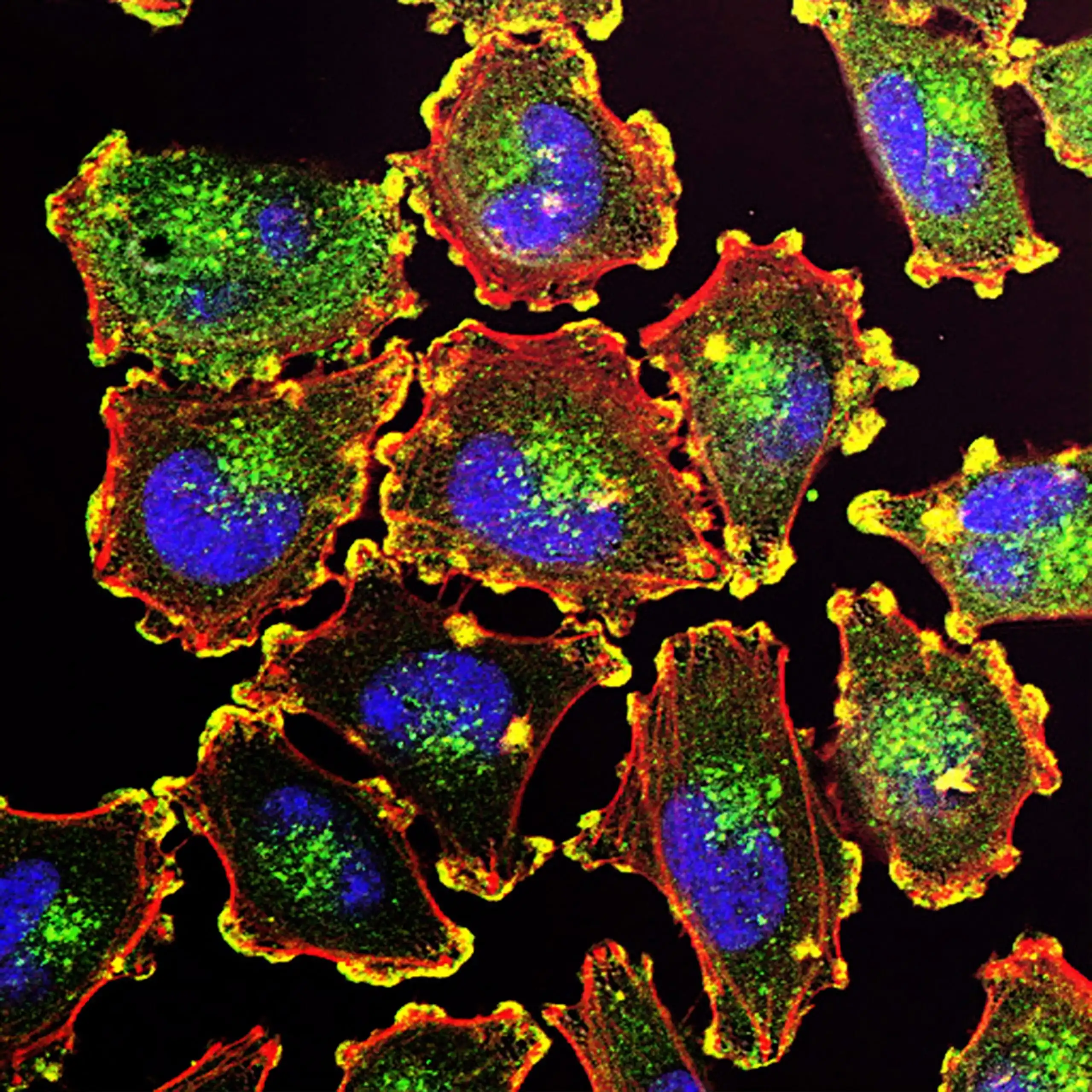 New Antibiotic Research, Developments, and Approvals (2023)